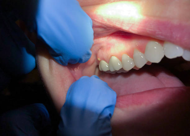 Best Emergency Denture Repair in Manassas Park, VA