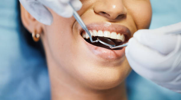 Best Emergency Wisdom Teeth Removal in Manassas Park, VA