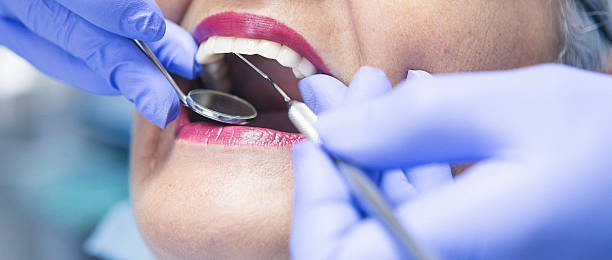 Best Emergency Treatment for Dental Infections or Abscesses in Manassas Park, VA